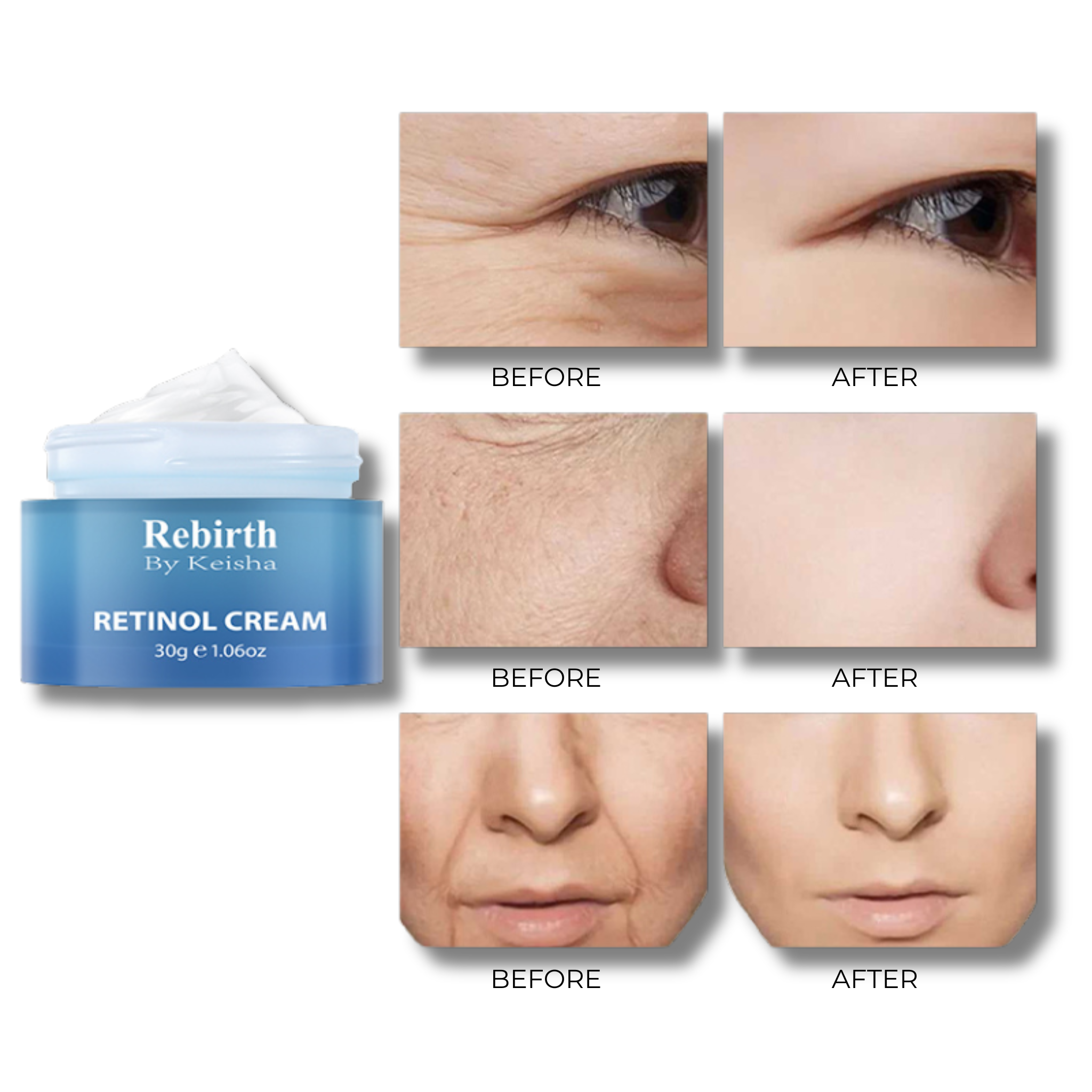 Retinol Cream